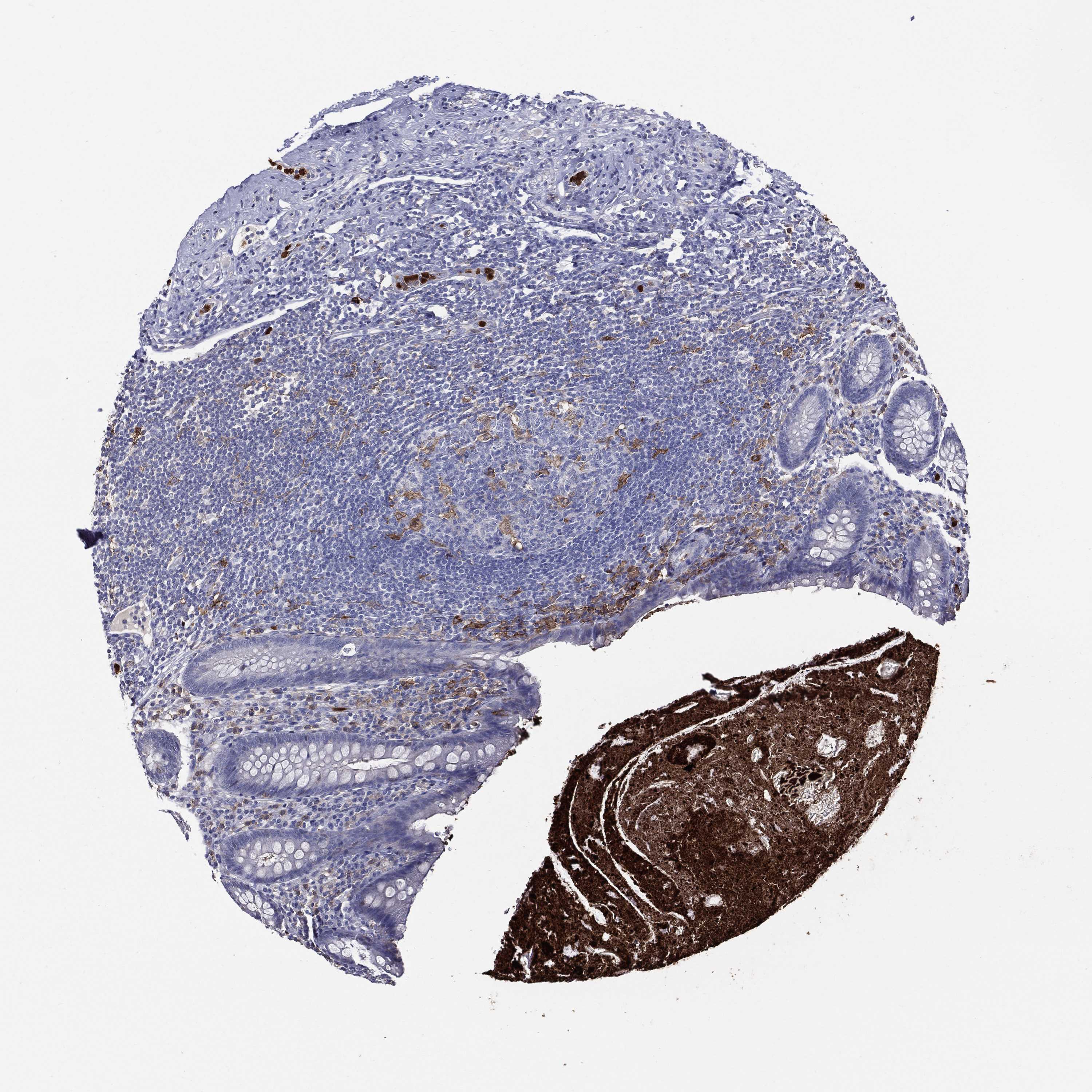 Tissue expression of GPR171 Staining in appendix The Human Protein