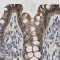 HPA IHC Colon — FADS2