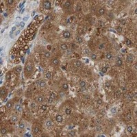 HPA IHC Liver — FADS2