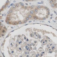 HPA IHC Kidney — FADS2