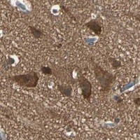 HPA IHC Cerebral cortex — TNFRSF21