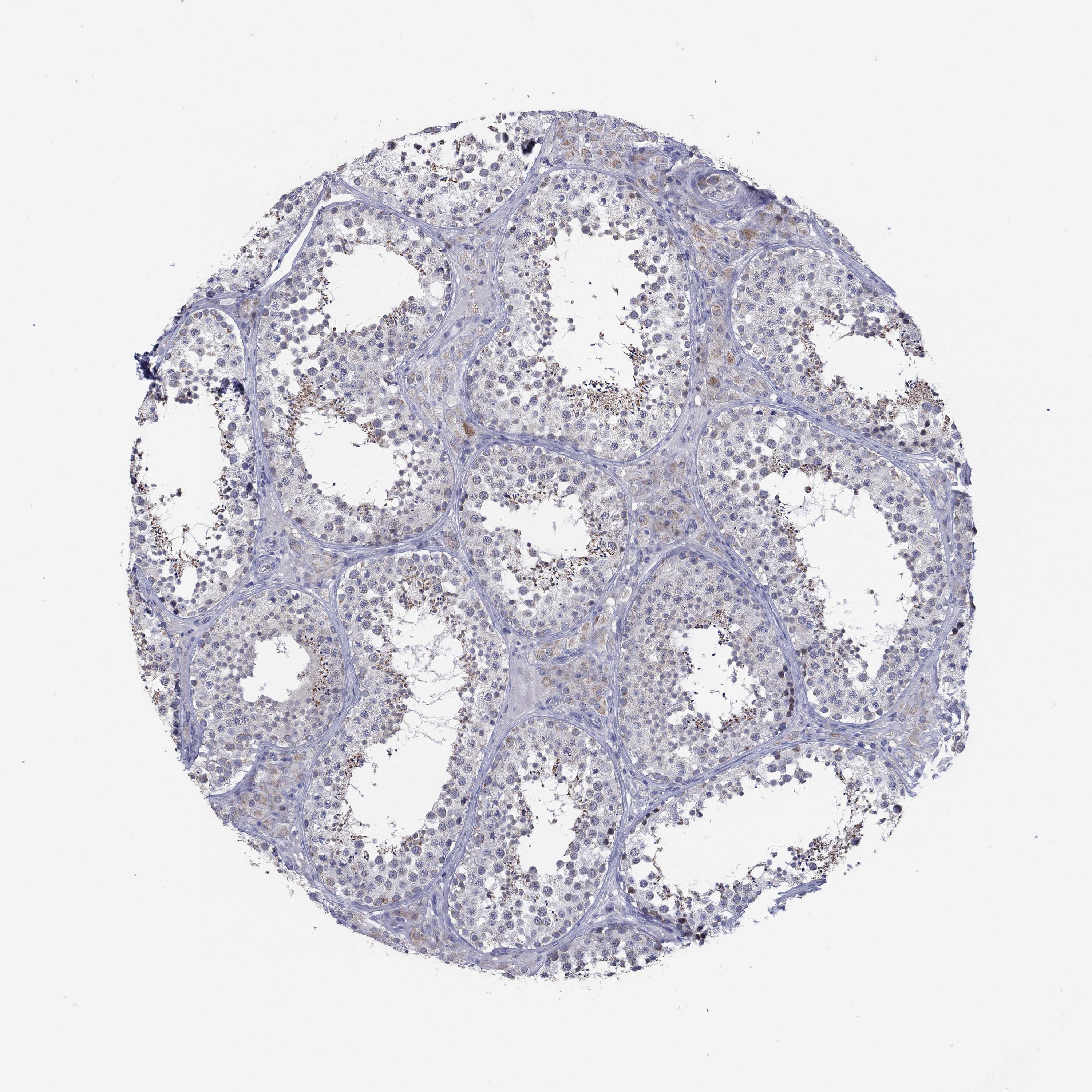 Tissue expression of SDC1 Staining in testis The Human Protein Atlas