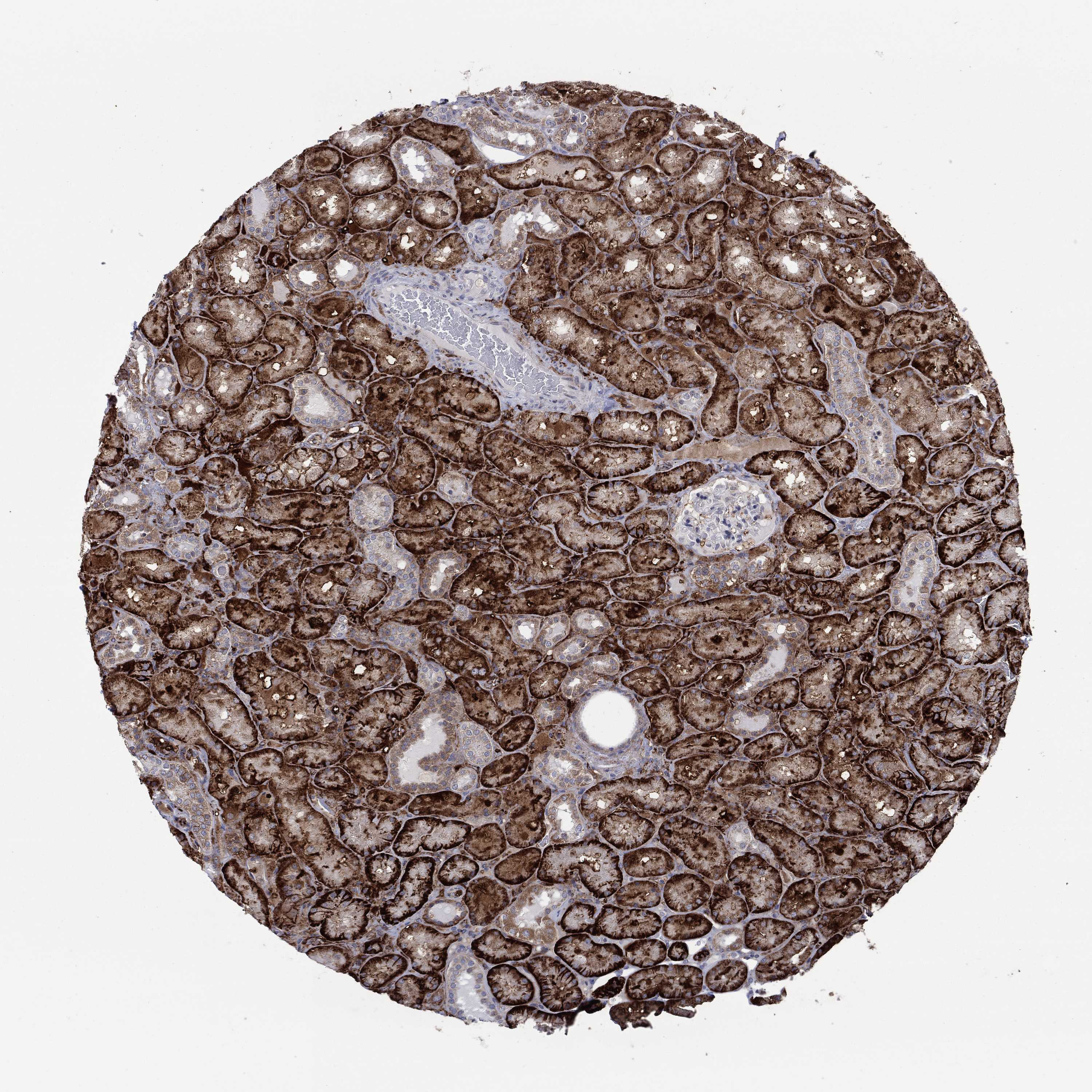 Tissue expression of SDC1 Staining in kidney The Human Protein Atlas