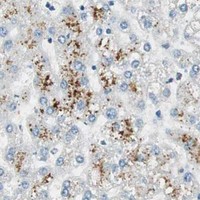 HPA IHC Liver — USP5