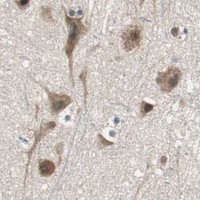 HPA IHC Cerebral cortex — USP5