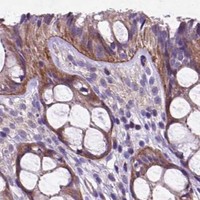 HPA IHC Colon — ATG4D
