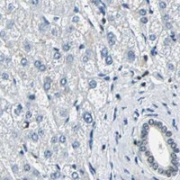 HPA IHC Liver — XRCC4