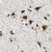 HPA IHC Cerebral cortex — XRCC4
