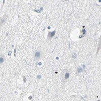 HPA IHC Cerebral cortex — SWAP70