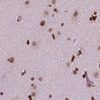 HPA IHC Cerebral cortex — CTCF