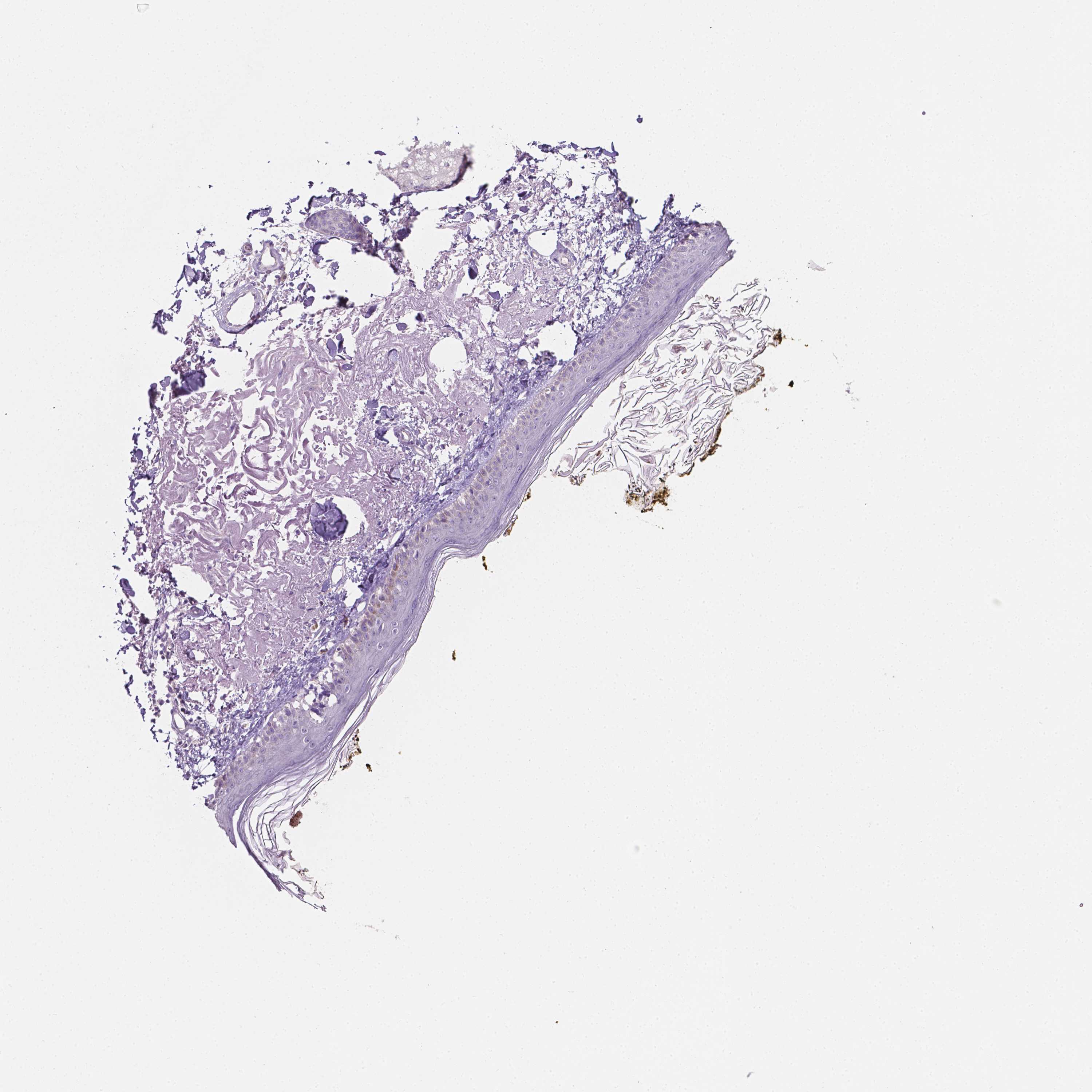 Tissue expression of EGFR Staining in skin The Human Protein Atlas