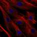 CAB068194: BJ [Human fibroblast]