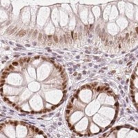 HPA IHC Colon — ZNF703