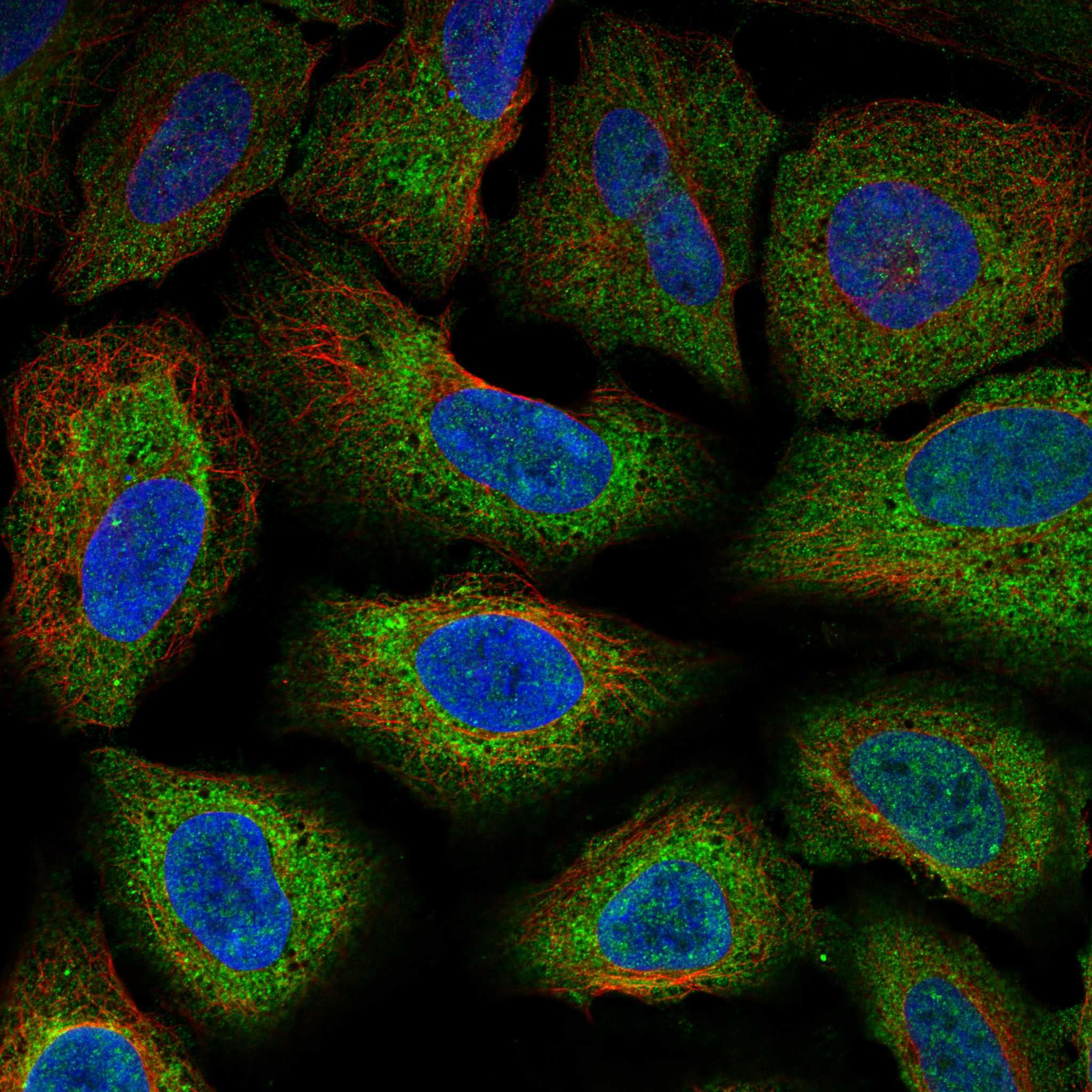 Subcellular COL1A2 The Human Protein Atlas