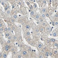 HPA IHC Liver — RRM2B