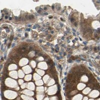 HPA IHC Colon — RRM2B