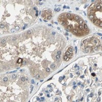 HPA IHC Kidney — RRM2B