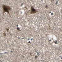 HPA IHC Cerebral cortex — RRM2B