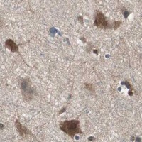HPA IHC Cerebral cortex — CAPNS1