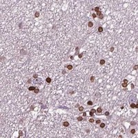 HPA IHC Cerebral cortex — PIP4K2A