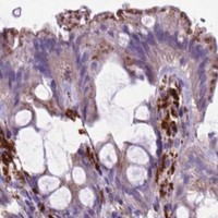 HPA IHC Colon — LZTR1