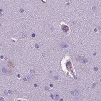 HPA IHC Cerebral cortex — LZTR1