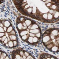 HPA IHC Colon — SPINT1