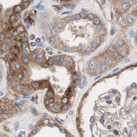 HPA IHC Kidney — SPINT1