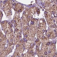 HPA IHC Liver — RPL29