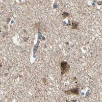 HPA IHC Cerebral cortex — ATP6V1A