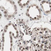 HPA IHC Kidney — RPA1