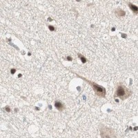 HPA IHC Cerebral cortex — MDC1