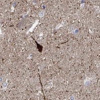 HPA IHC Caudate — NOS1