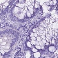 HPA IHC Colon — FOXL2