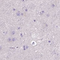 HPA IHC Cerebral cortex — FOXL2