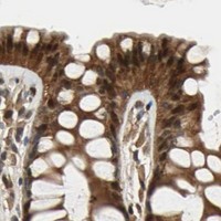 HPA IHC Colon — PRDX6