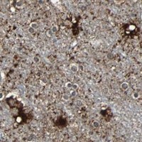 HPA IHC Cerebral cortex — PRDX6