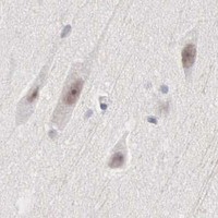 HPA IHC Cerebral cortex — MNAT1
