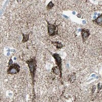 HPA IHC Cerebral cortex — ACVRL1