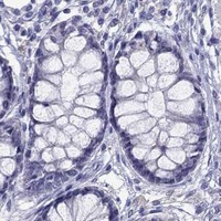 HPA IHC Colon — PPP1R3A