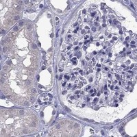 HPA IHC Kidney — PPP1R3A