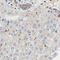 HPA IHC Liver — ATG4C