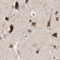 HPA IHC Cerebral cortex — ATG4C