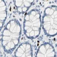 HPA IHC Colon — IL33