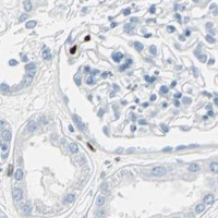 HPA IHC Kidney — IL33