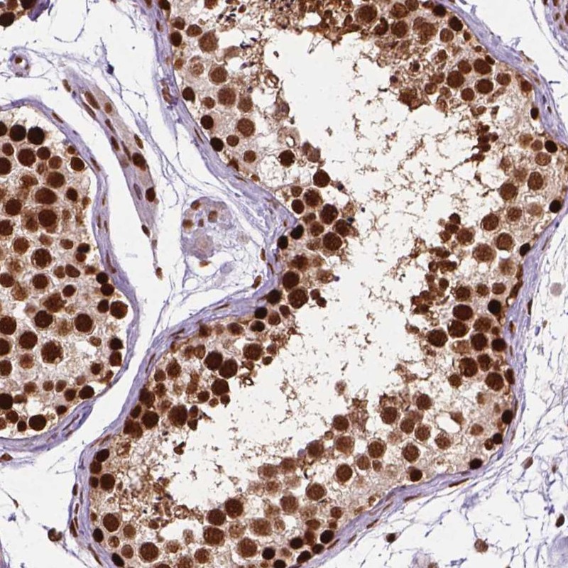 MLH1 - Antibodies - The Human Protein Atlas