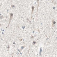 HPA IHC Cerebral cortex — RAD54B