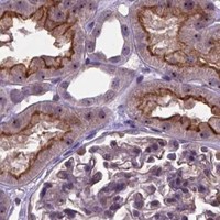 HPA IHC Kidney — RUNX1T1