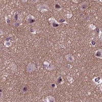 HPA IHC Cerebral cortex — RUNX1T1