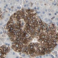 HPA IHC Pancreas — TRPV4